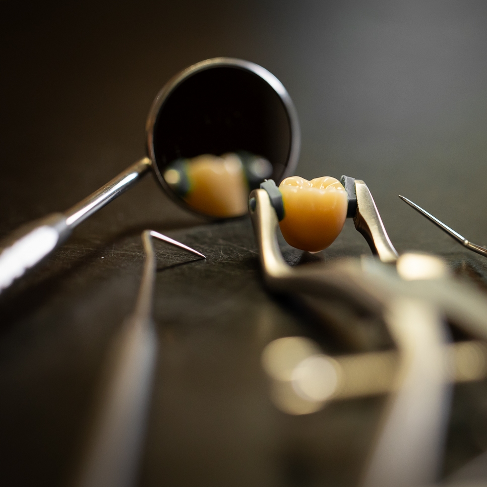 Implantate – Dentalmanufaktur Arnold